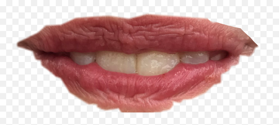 The Most Edited - Lip Care Emoji,Puckiing Emoji