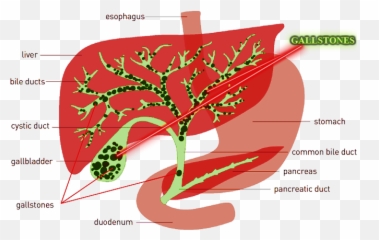 Liver Cleanse - Purple House Natural Therapies Liver Gallbladder Cleanse Emoji,Liver And Emotions