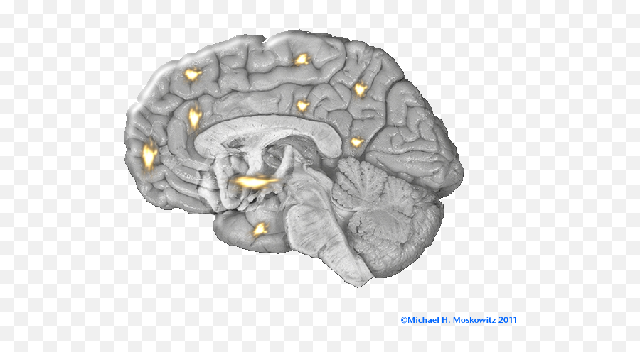 Teresa Jade Leyungu0027s Blog - Chronic Pain Brain Map Emoji,Human Ingenuity Emotions