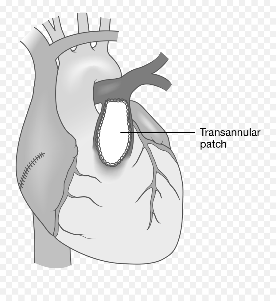 Cardiovascular System Springer Publishing - Heart Emoji,Tripartite Model Of The Impact Of The Family On Children’s Emotion Regu- Lation And Adjustment. Cardiovascular System Springer Publishing - Heart Emoji,Tripartite Model Of The Impact Of The Family On Children’s Emotion Regu- Lation And Adjustment.