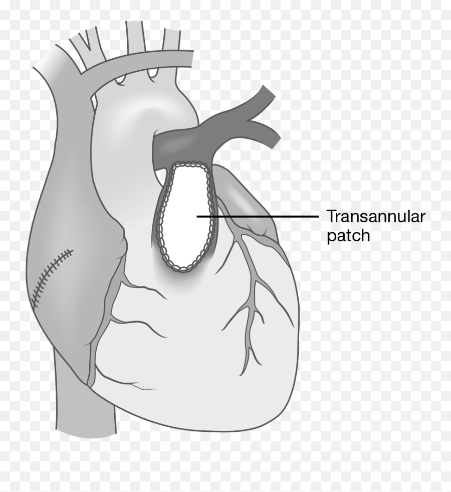 Cardiovascular System Springer Publishing - Heart Emoji,Tripartite Model Of The Impact Of The Family On Children’s Emotion Regu- Lation And Adjustment.