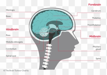 Haemangioblastomas - Signs And Symptoms Of Astrocytoma Emoji,Surgery Cut Open Brain And No Emotion