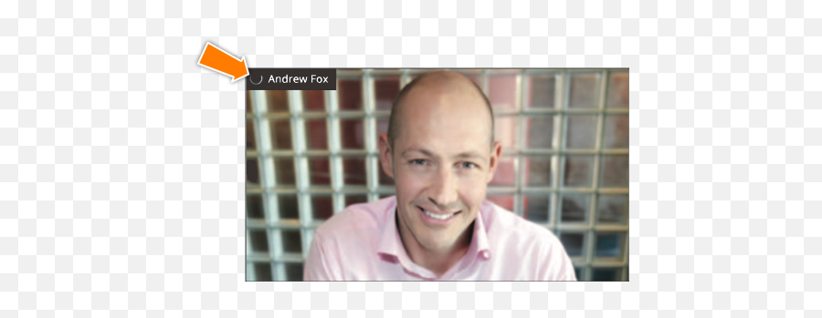 2018 Updates - Hair Loss Emoji,Lost Second Front Tooth Emojis 2018 Updates - Hair Loss Emoji,Lost Second Front Tooth Emojis