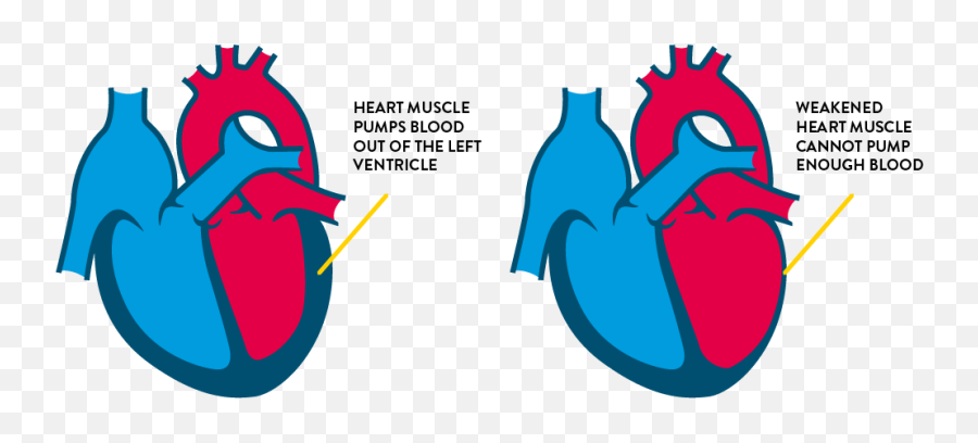 Congestive Heart Failure Drawing - Congestive Heart Failure Cartoons Emoji,The Beatitudes Using Emojis