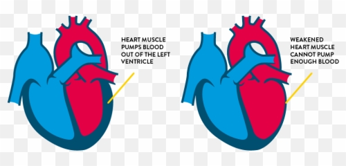 Congestive Heart Failure Drawing - Congestive Heart Failure Cartoons Emoji,The Beatitudes Using Emojis