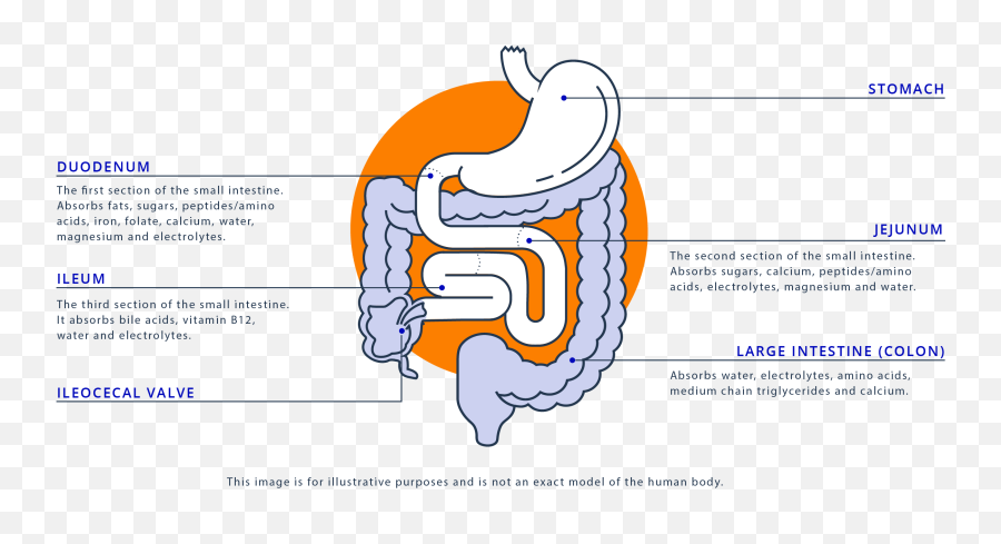 What Is Short Bowel Syndrome - Ileocecal Resection Emoji,Emotion Code Small Intestine Acen