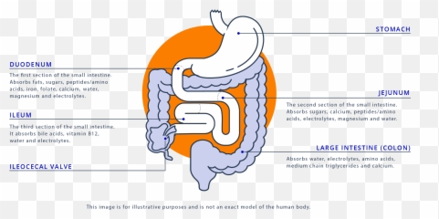 What Is Short Bowel Syndrome - Ileocecal Resection Emoji,Emotion Code Small Intestine Acen