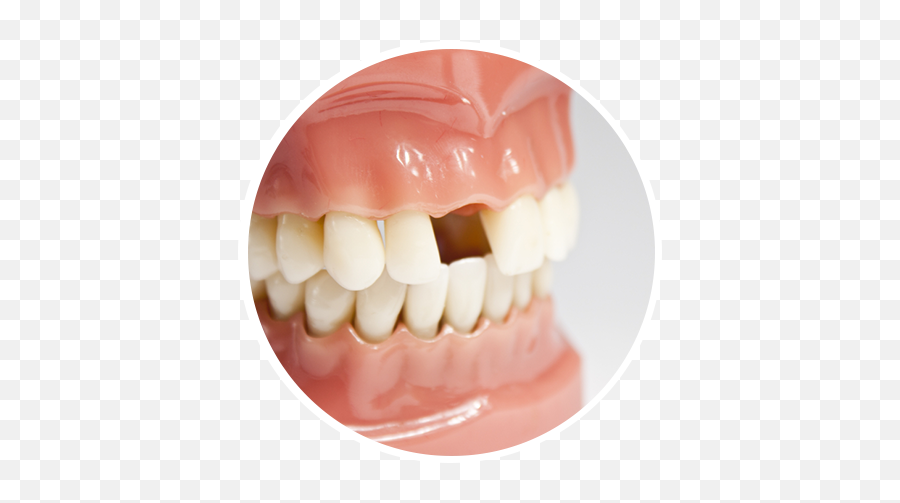 Pediatric Emergency Care - Sycamore Orthodontics U0026 Pediatric Emoji,Face With Stuck-out Tongue & Winking Eye Emoticon