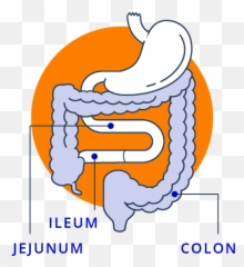What Is Short Bowel Syndrome - Language Emoji,Emotion Code Small Intestine Acen