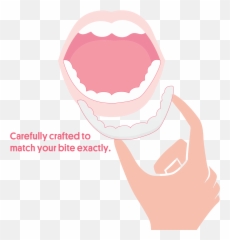 The Affordable Custom Night Guard Service - Copy Cheeky Emoji,Teeth Grit Emoticon