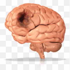 10 Cognitive Distortions - Diseased Brain Emoji,Emotion Advantedge