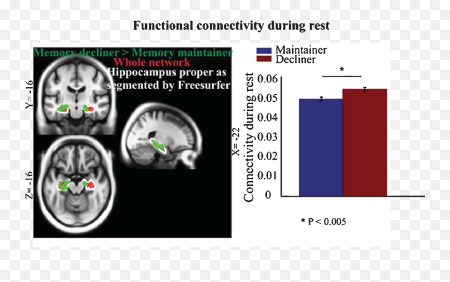 Increased Resting State Connectivity Between Left And Right - Computed Tomography Emoji,Geon Emotions