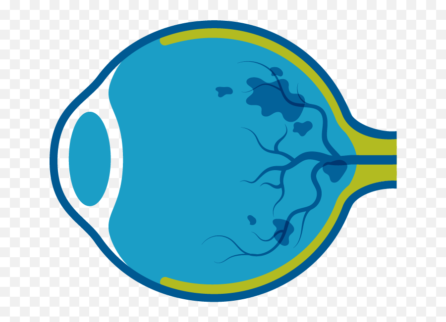 Genentech Understanding Rvo Emoji,Upsr Swelling Of Emotion