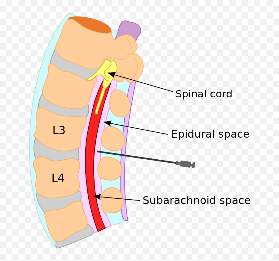 Er Visit 2 Blood Patch My Familyu0027s New Normal - Cerebrospinal Fluid Spine Emoji,Emoticon For Inpatient