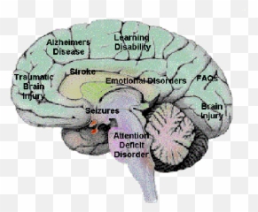 Attention - Deficit Hyperactivity Disorder Asb Ap Psychology Brain Disorder Emoji,Ap Psych Theories Of Emotion