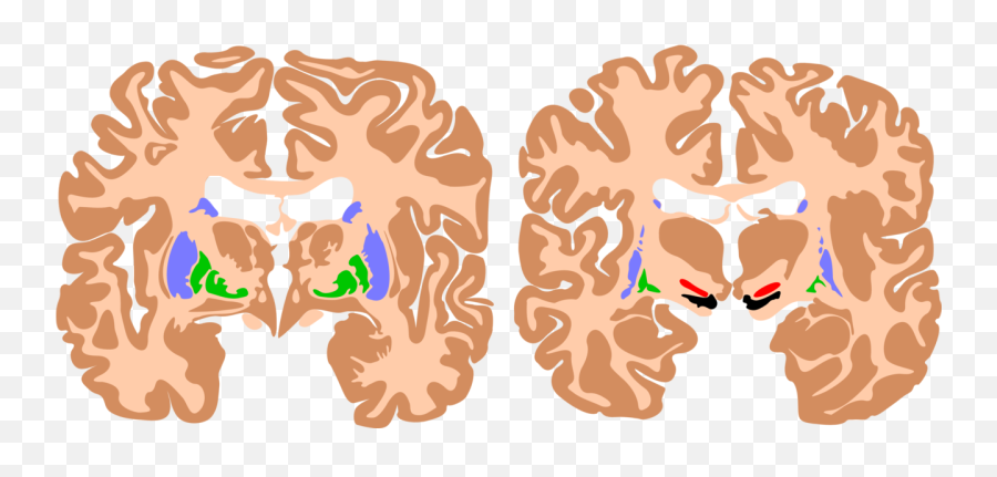 Neuroanatomy Basal Ganglia Article Emoji,Comlex Emotions