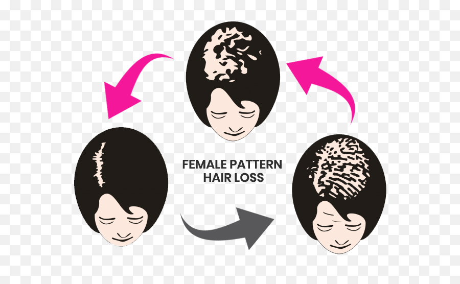 Hair Loss Treatment In Delhi - Make An Appointment Today Hair Design Emoji,Salon Emotion Loreal