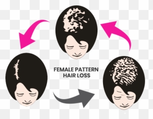 Hair Loss Treatment In Delhi - Make An Appointment Today Hair Design Emoji,Salon Emotion Loreal