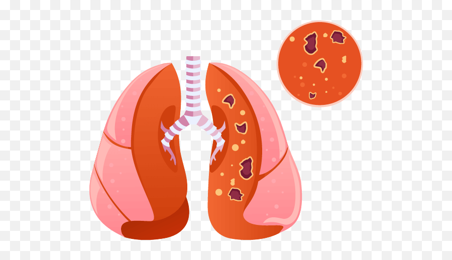 Comprehensive Guide To Copd Updated For 2021 - Clipart Chronic Bronchitis Png Emoji,Organ Emotions Anxiety