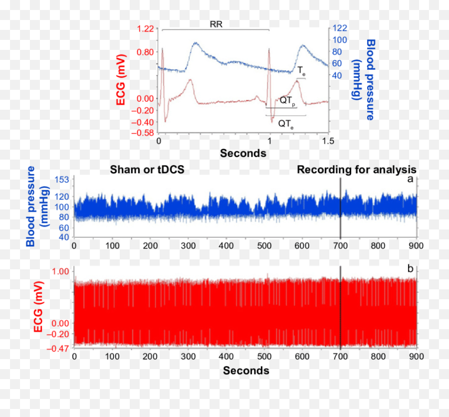 Minute Recording During Sham Emoji,Carthodic Emotions