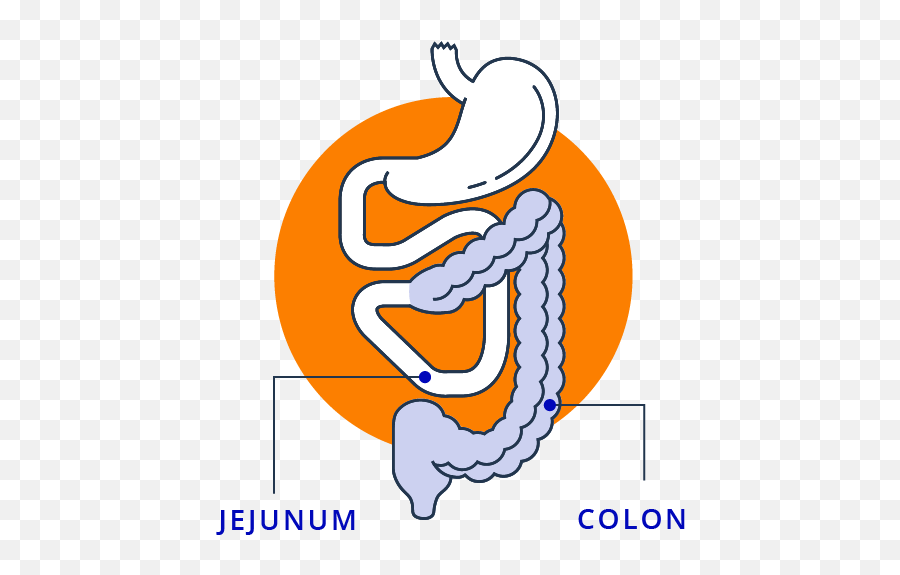 What Is Short Bowel Syndrome - Language Emoji,Emotion Code Small Intestine Acen