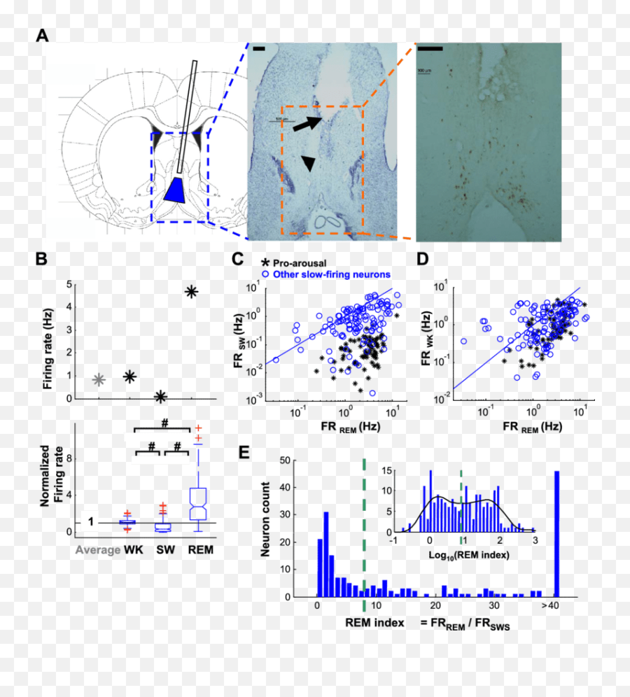 Slow - Firing Neurons Have Higher Firing Rate In Rapid Eye Emoji,Ledoux Theory Of Emotion Chart