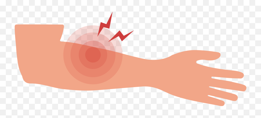 Forearm Pain Causes - Illustration Emoji,Hand Gripping Hand Tightly Emotion
