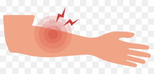 Forearm Pain Causes - Illustration Emoji,Hand Gripping Hand Tightly Emotion