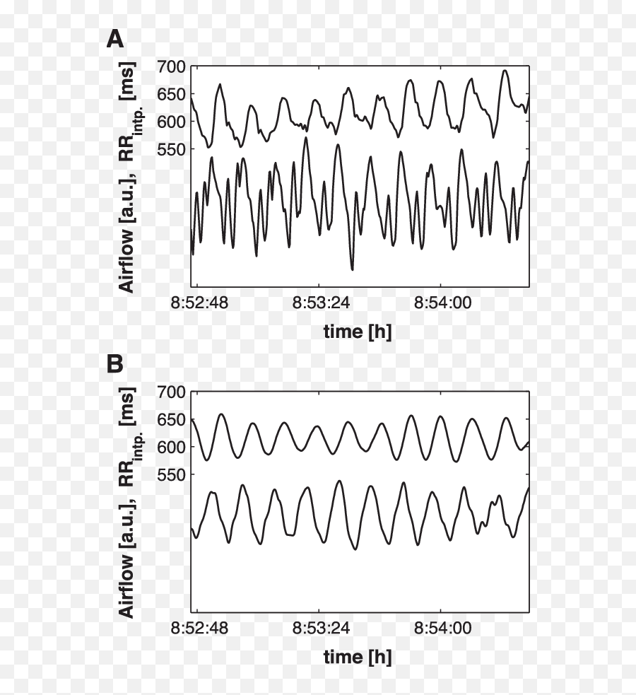 A Heart Rate Time Series Derived From The Interpolated R - R Plot Emoji,Heartbeat Emotions Cd Download