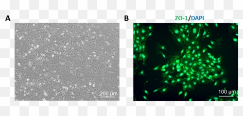 Human Small Intestine Epithelial Cells - Small Intestinal Eptielial Cells Emoji,Emotion Code Small Intestine Acen