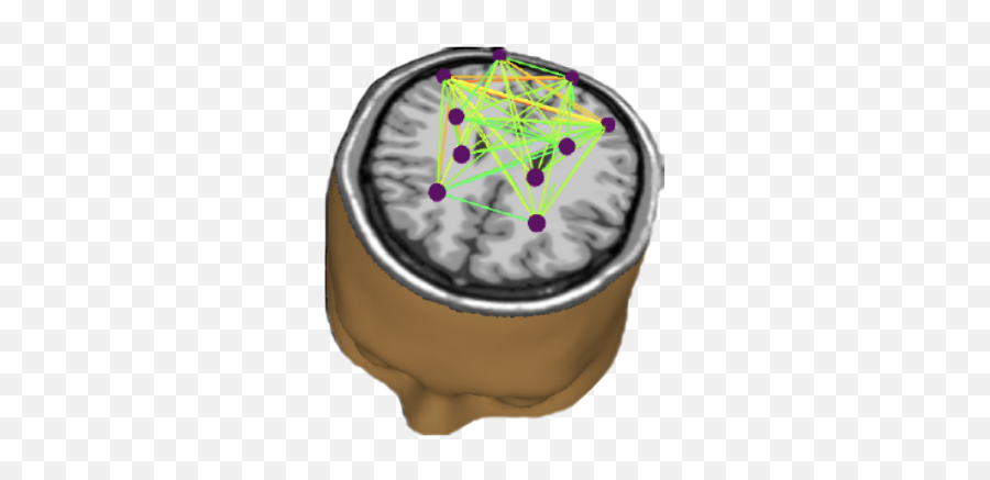 How It Works - Esmartr Mindful Solutions With Cbt Dot Emoji,The Emotion Code The Sway Test