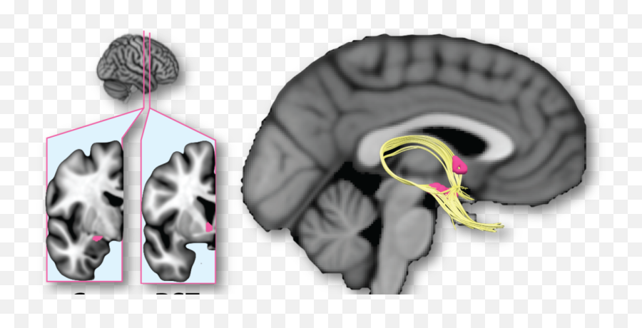 Alexander Shackman Shackmanlab - Computed Tomography Emoji,Carol Gray Emotions