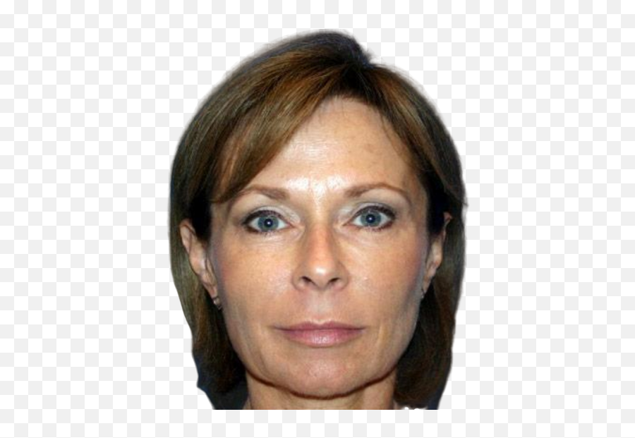 Non Surgical Face Lift - Liquid Facelift Emoji,Facial Assymtry Of Emotion