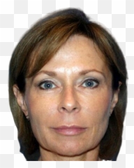 Non Surgical Face Lift - Liquid Facelift Emoji,Facial Assymtry Of Emotion