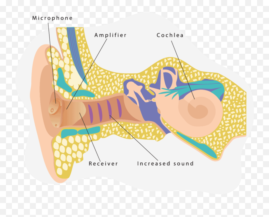 Hearing Aid Buying Guide What To Expect Before You Buy - Horizontal Emoji,Emotion Code For Hearing Problems