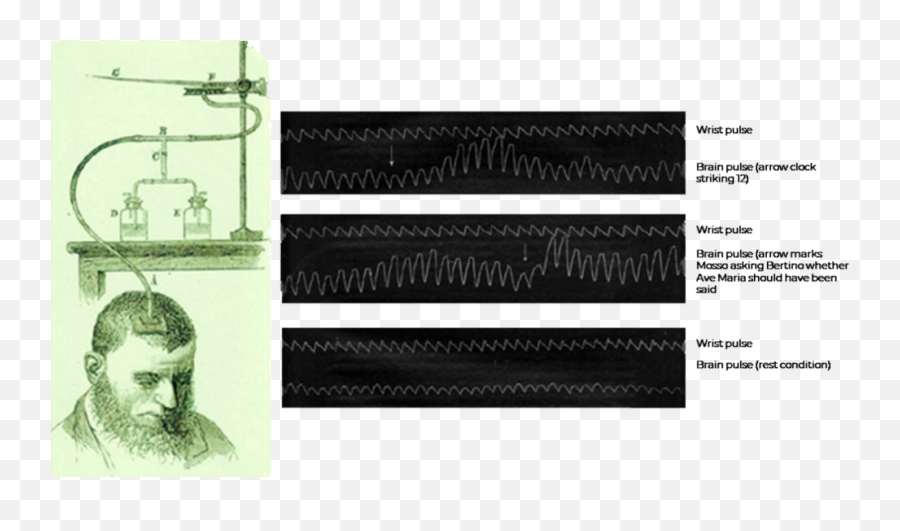 Angelo Mosso And The Human Circulation Balance U2014 Tim Lawn Emoji,The Many Emotions Of Tim Duncan