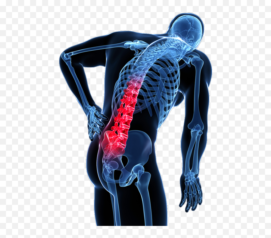 Top Paines Stickers For Android Ios - Back Pain No Background Emoji,Headache Animated Emoticon
