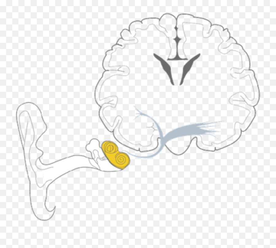 Discrimination Loss Widex - Language Emoji,Emotion Code For Hearing Problems