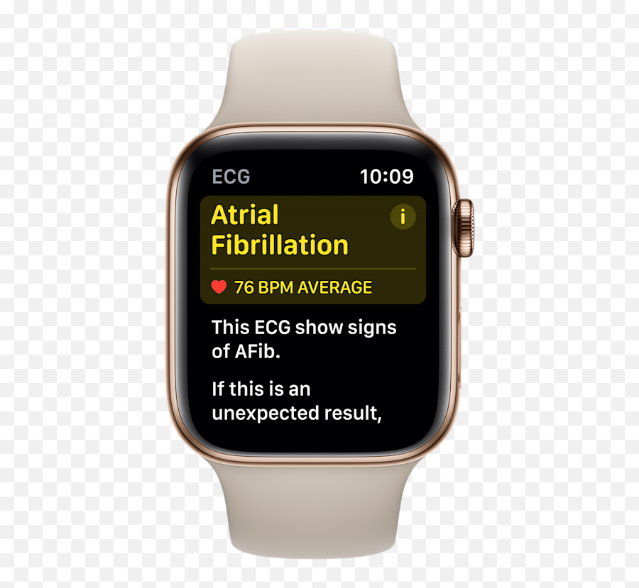 Apple Watch Ecg Feature To Detect Irregular Heart Beat Emoji,Ecg Emotion Measure