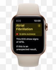 Apple Watch Ecg Feature To Detect Irregular Heart Beat Emoji,Ecg Emotion Measure