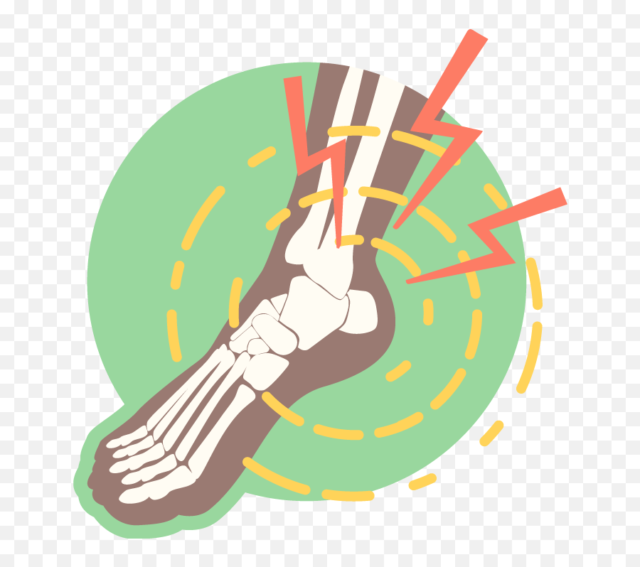 Foot And Ankle Conditions - Illustration Emoji,Hayward On Emotions Of Ankle Injury