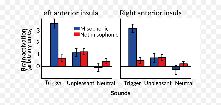 If Chewing Sounds Irk You Blame Your Brain Science News - Statistical Graphics Emoji,Emotion Regulation Grapgic