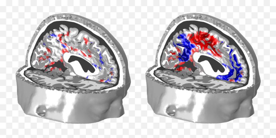 Eeg For Optimizing Communication Processes - Neuroelectrics Computed Tomography Emoji,Emotion And Memort