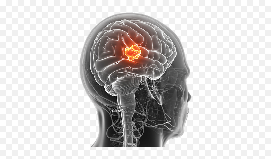 3d Endoscope To Boost Safety Cut Costs Of Surgery Nasa - Brain Cancer Symptoms Emoji,Surgery Cut Open Brain And No Emotion