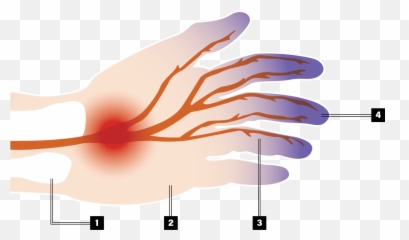 Hytorc Singapore Vibration Safety - Active Vibration Control Emoji,Hand With Vibrations Emoji