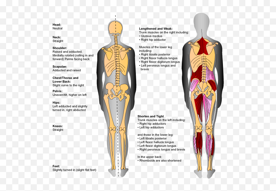 Specific Muscles U2013 Weak Versus Tight Lower Leg Muscles Emoji,Emotion With Misaligned Hips And Psoas