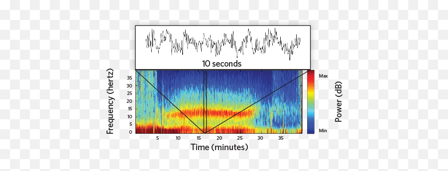 General Anesthesia Causes Telltale Brain Activity Patterns Emoji,Emotions Connected With Eeg Waves