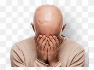 Ok Hand Png - Man With Scarring On Head Holding Hands To Man Holding Head Png Emoji,Head In Hands Emoji