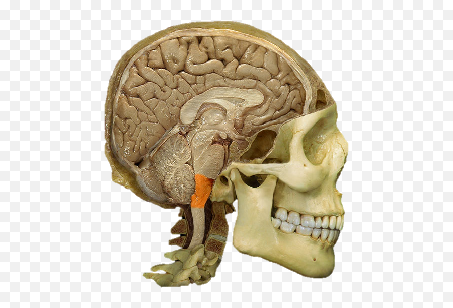 Brain Flashcards Cheggcom - Fourth Ventricle Highlighted Emoji,Oblique Emotion