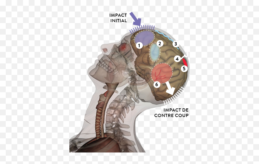 La Fondation Neurotrauma Marie - Robert Bien Comprendreles Traumatisme Cranien Grave Emoji,Cerveau Gauche Emotion